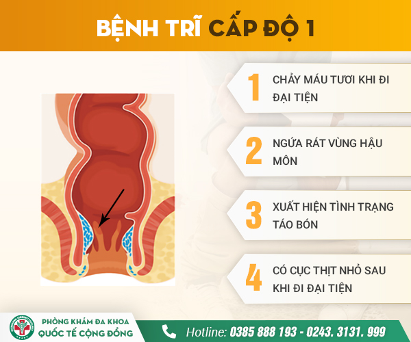 10 điều cần biết về Bệnh trĩ Nguyên nhân, triệu chứng, phát hiện, điều trị và phòng ngừa